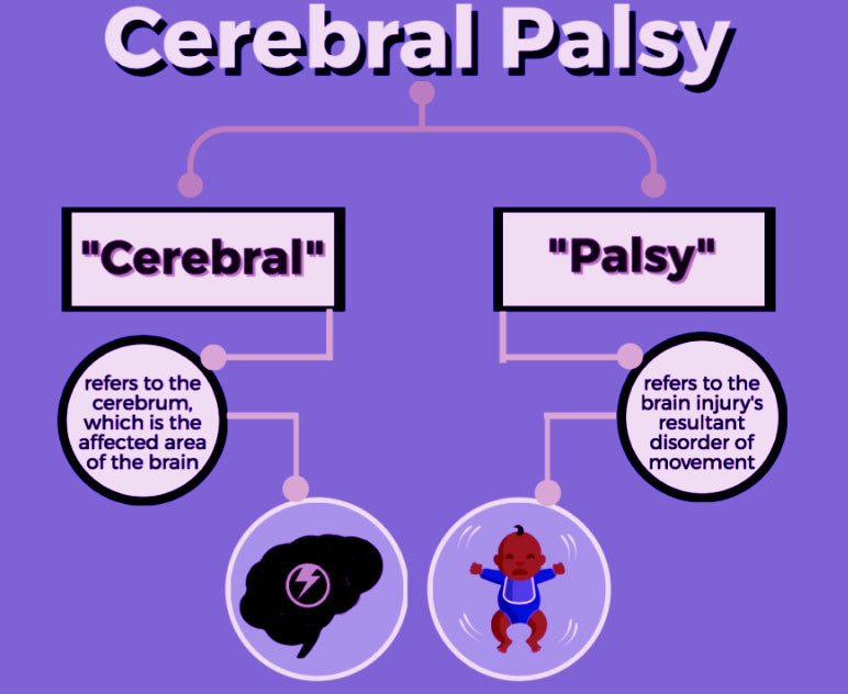 Cerebral palsy diagram