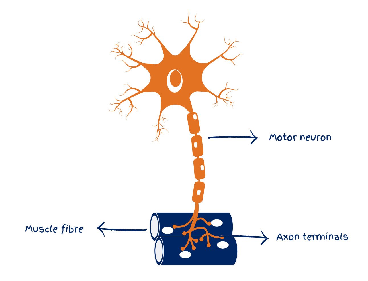 Motor neuron disease diagram