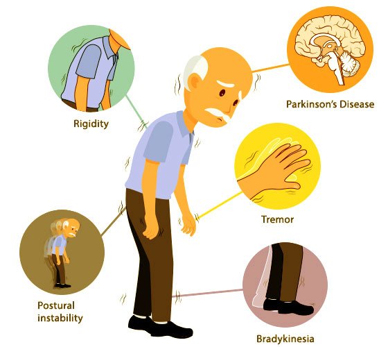 Parkinson's disease brain dopamine diagram