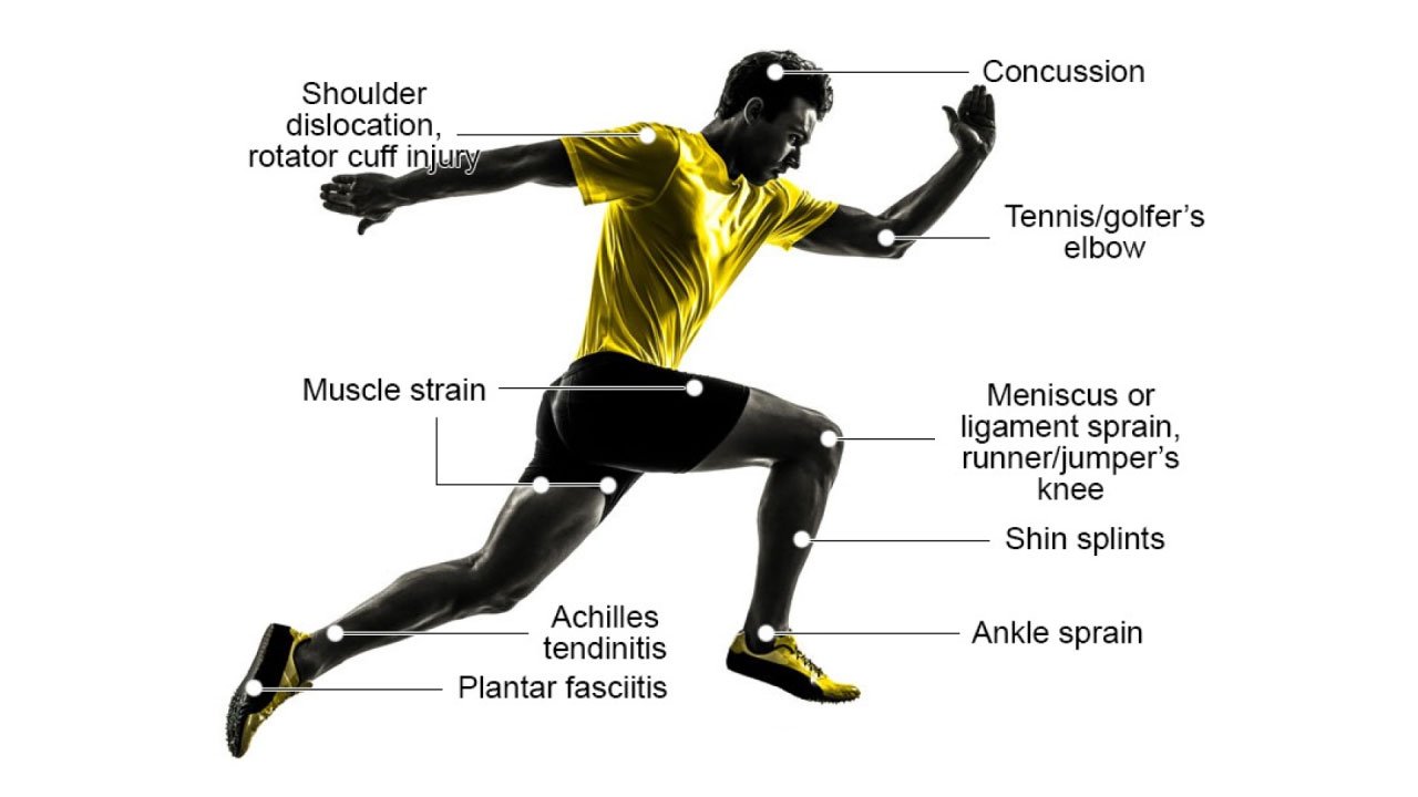 Sports injury diagram