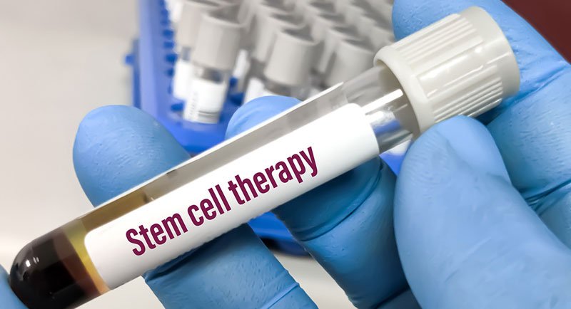 How stem cell therapy works
