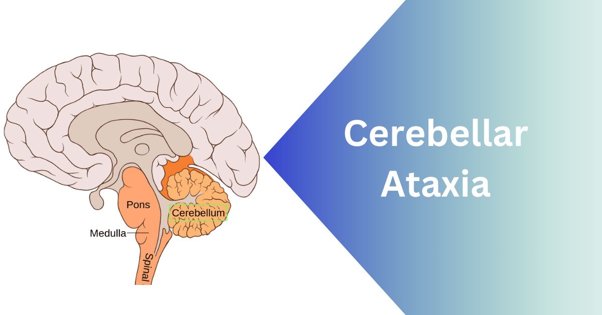 Ataxia neurological condition diagram